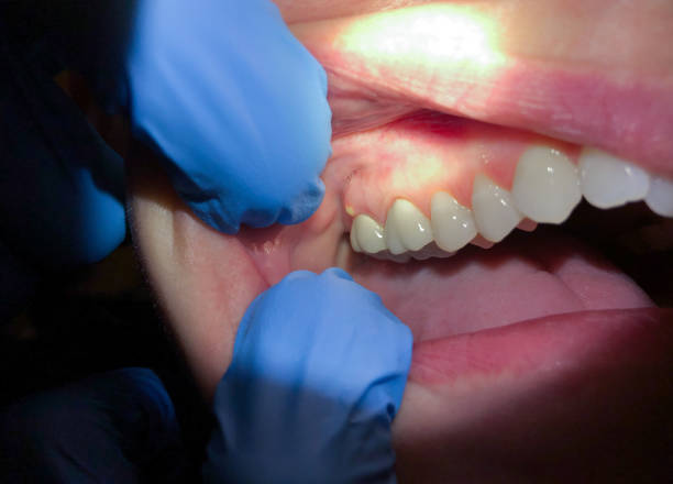 Best Cosmetic Emergency Dentistry in Oxford, GA