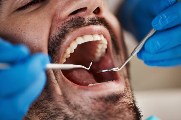 Best Pediatric Emergency Dentist in Oxford, GA